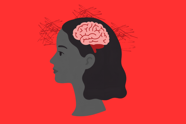 Fuzzy Brain